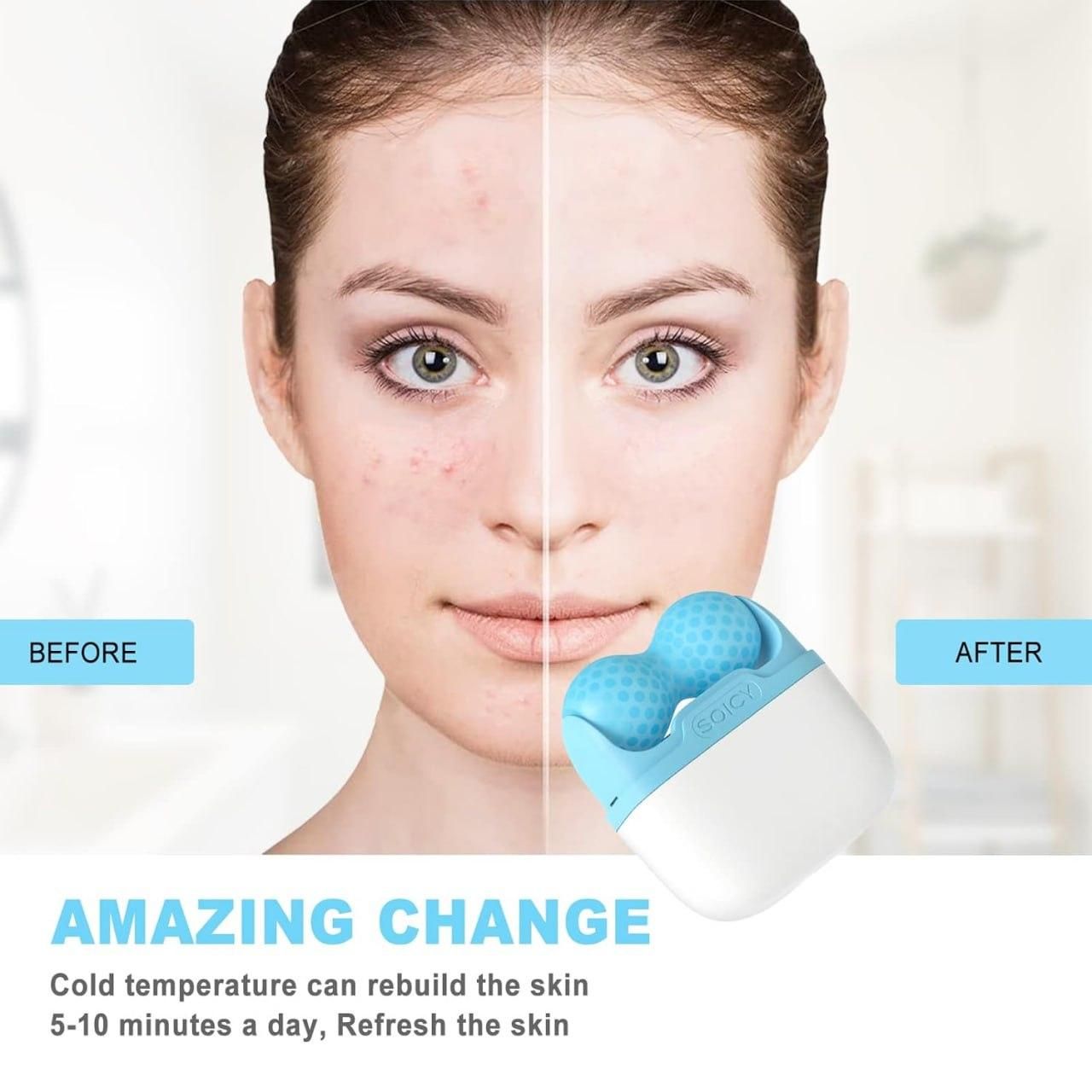 2-in-1 Upgraded Ice Roller – Face & Eye Therapy, Neck & Body Relief | Depuffing, Redness Relief, Soothes Muscles – Dual-Sided Skincare & Recovery Essential